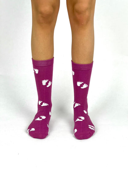 Prenataal/Prematuur paars